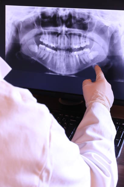 Best Emergency Dental Care for Broken or Chipped Teeth in Valley Springs, CA